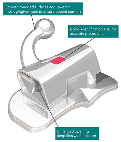 Wise Buccal Tubes