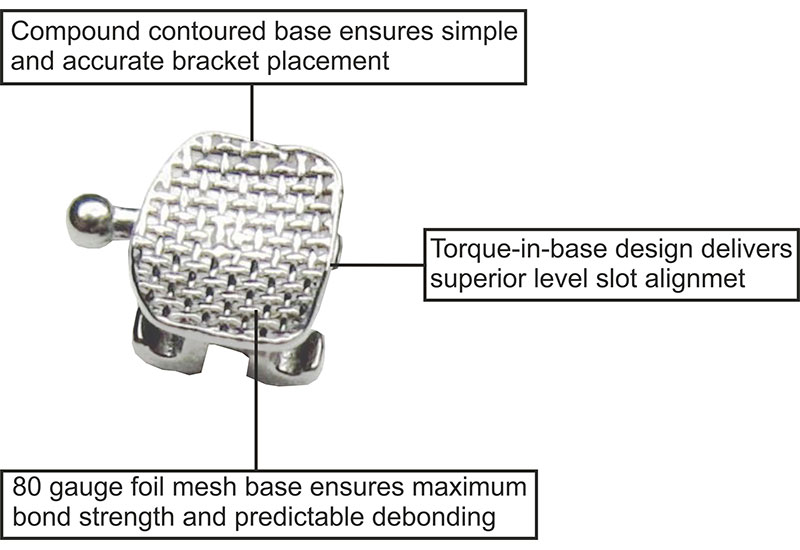 Metal Brackets