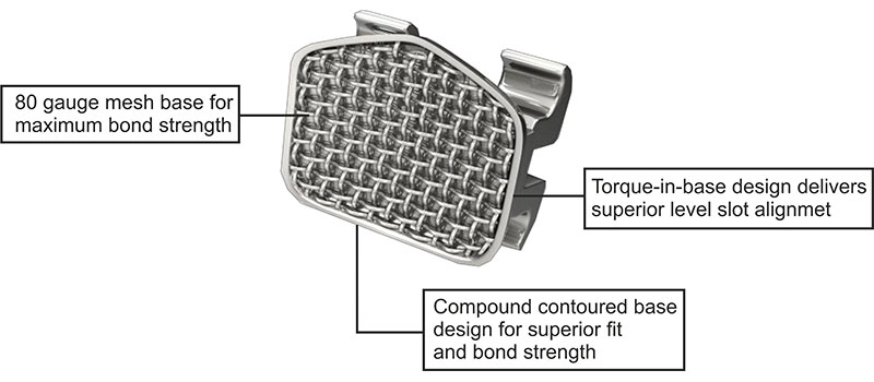 Metal Brackets